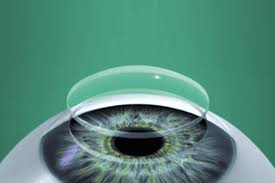 Corneal Transplant